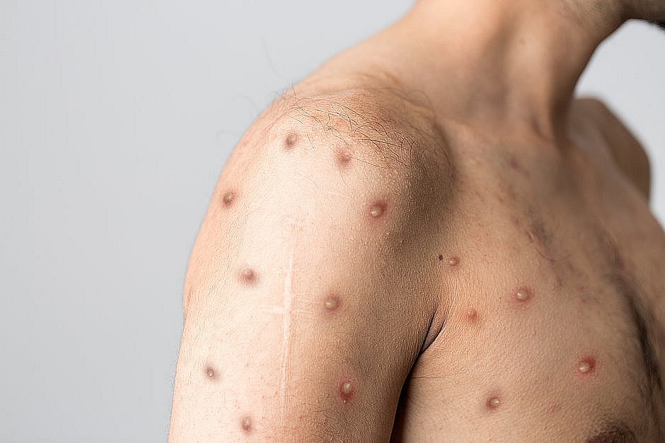 (Foto: Shutterstock)